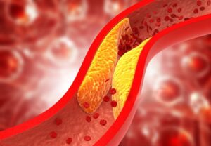 cholesterol
