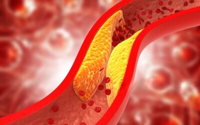 cholesterol