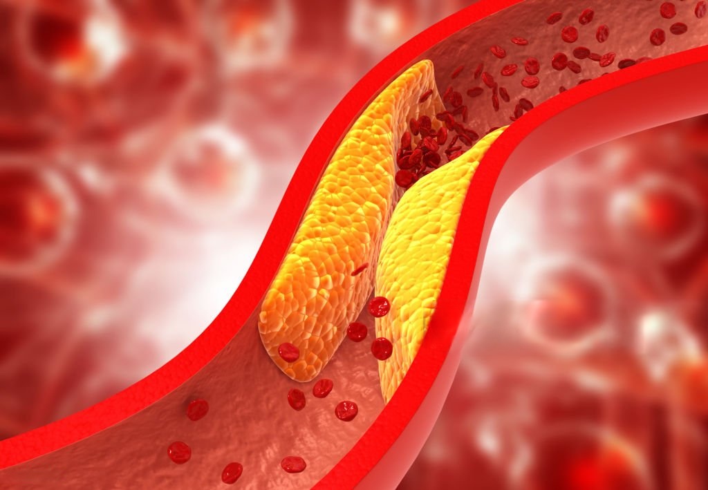 cholesterol